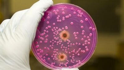 Patoloogiline eritis meestel, kui nad on erutatud